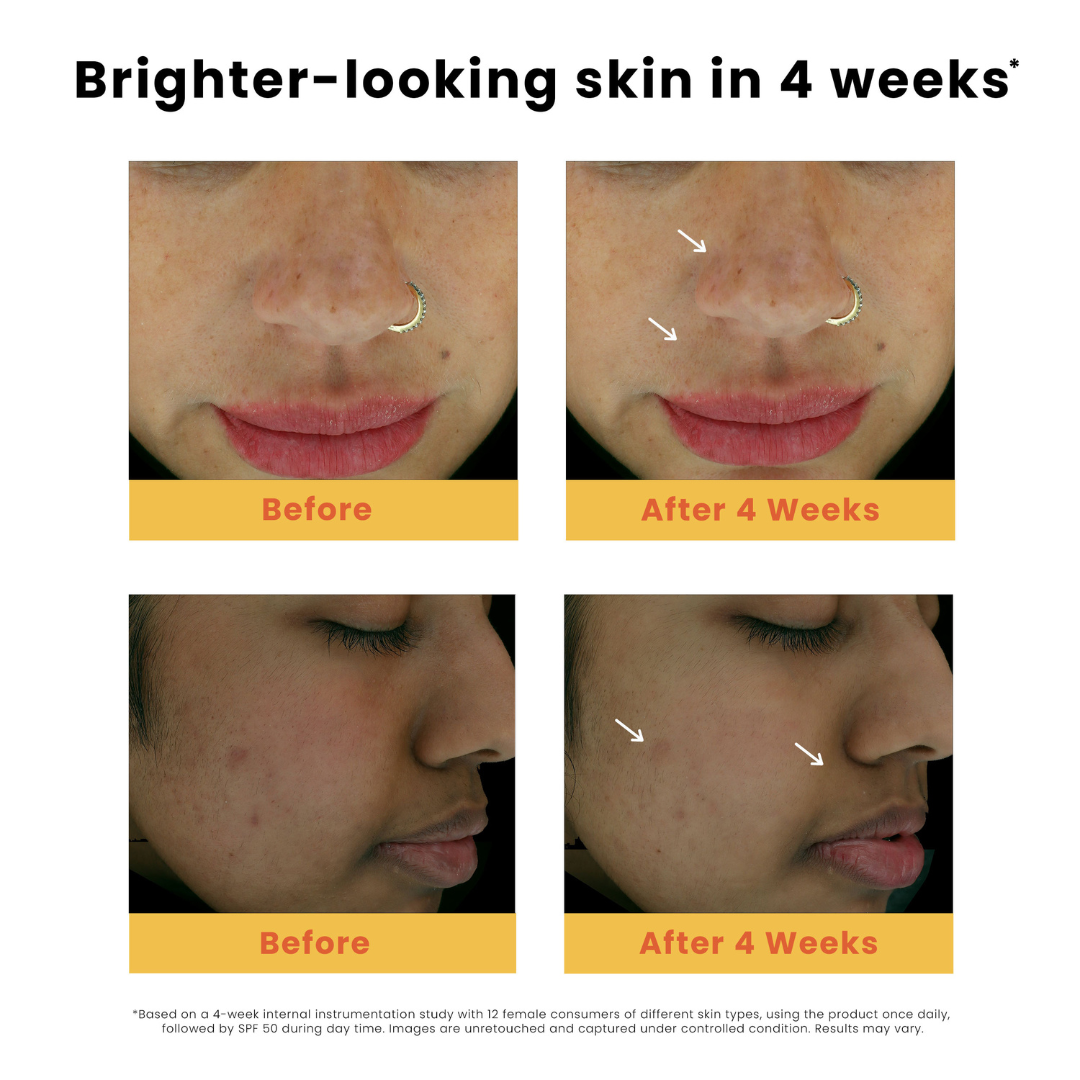 Dark Spot Clearing Turmeric Face Serum