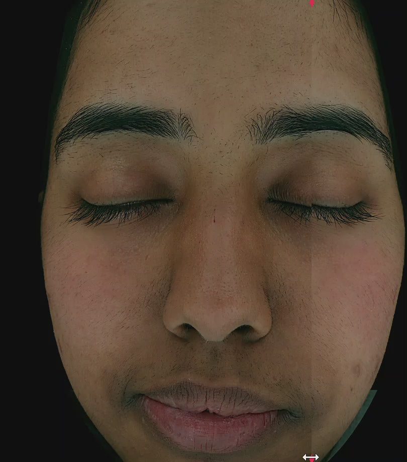 Dark Spot Clearing Turmeric Face Serum